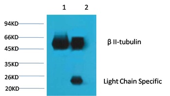 β II tubulin Mouse mAb Antibody
