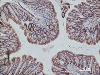 eNOS Mouse mAb Antibody