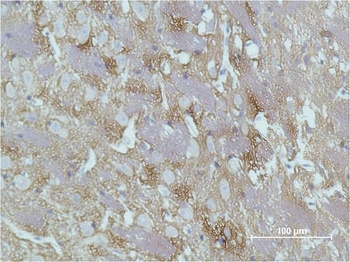 GAP43 Mouse mAb Antibody