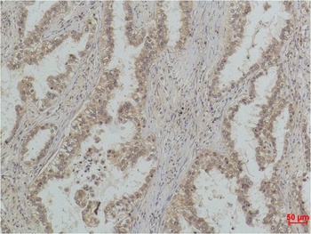 P53(Mono Methyl Lys370) Mouse mAb Antibody