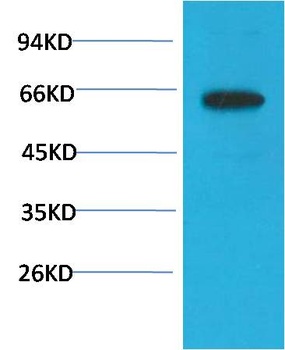 Phospho-Akt (S473) (6F8) Mouse mAb