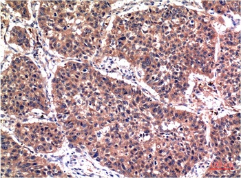 Phospho-Akt (S473) (6F8) Mouse mAb