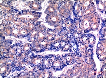 GSK3β (2C6) Mouse mAb Antibody
