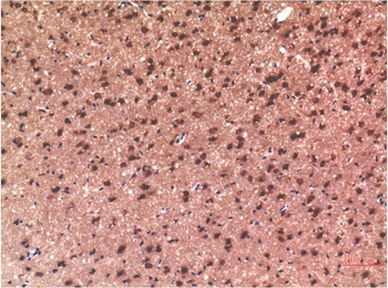 Tau (10E3) Mouse mAb Antibody