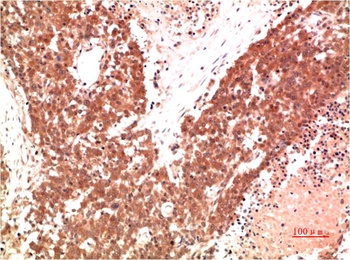 AMPKα1 (9G3) Mouse mAb Antibody