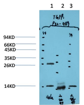 TGFβ1 (4B9) Mouse mAb Antibody
