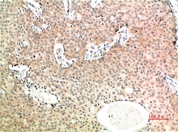 TGFβ1 (4B9) Mouse mAb Antibody