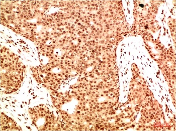 Acetyl NF kB P65（K314/K315) (5G11) Mouse mAb Antibody