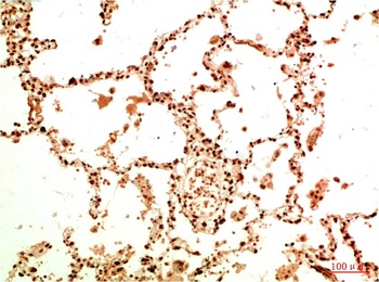 Acetyl NF kB P65(K314/K315) (5G11) Mouse mAb Antibody