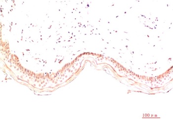 Collagen I (4B5) Mouse mAb Antibody