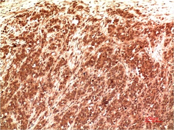 Claudin-2 (8H11) Mouse mAb Antibody