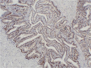 P63-α (3F11) Mouse mAb Antibody