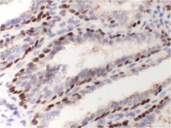 P63-α (3F11) Mouse mAb Antibody