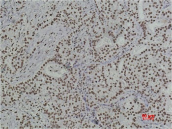Histone H3 (di methyl K79) Monoclonal antibody