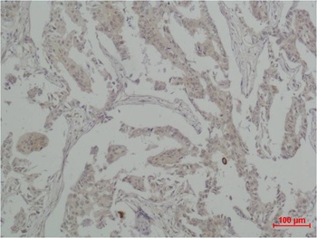 Vinculin Rabbit pAb Antibody