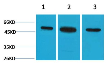 β II Tubulin Rabbit pAb Antibody
