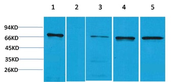 ZNF499 Rabbit pAb Antibody