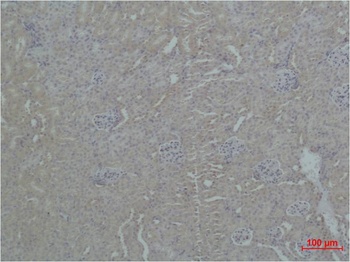 ZNF499 Rabbit pAb Antibody