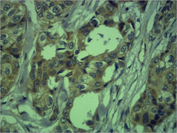 Vimentin Rabbit pAb Antibody