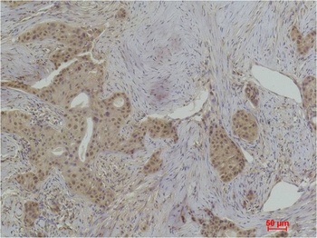 Histone H1(Phospho Thr17) Rabbit pAb Antibody