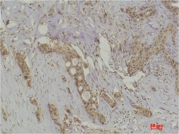 Histone H4(Acetyl Lys91) Rabbit pAb Antibody