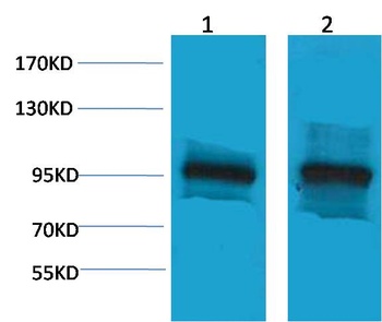 β-Catenin Rabbit pAb Antibody
