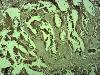 β-Catenin Rabbit pAb Antibody