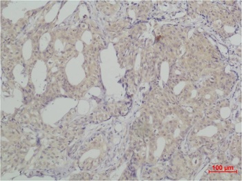 SLUG Rabbit pAb Antibody