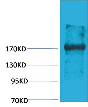 EPG5 Rabbit pAb Antibody
