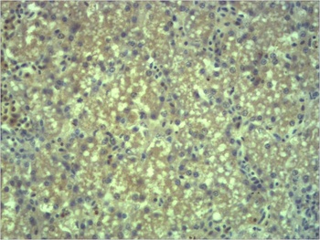 EPG5 Rabbit pAb Antibody