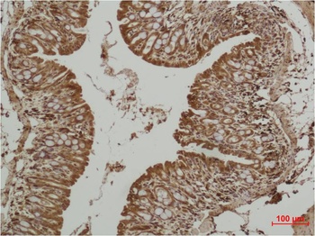 P53 Rabbit pAb Antibody