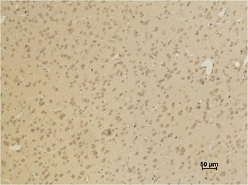 AMPA Receptor 4(GluA4) Rabbit pAb Antibody