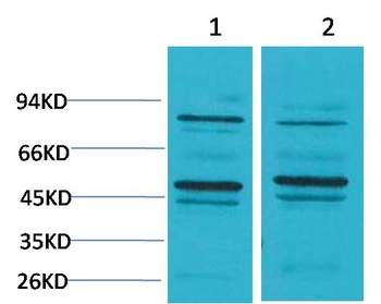 Bestrophin-2 Rabbit pAb Antibody