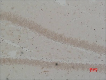Bestrophin-2 Rabbit pAb Antibody