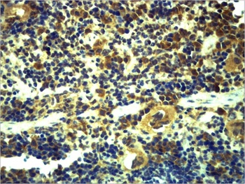 TLR6 Rabbit pAb Antibody
