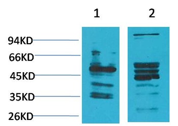 NMBR (Bombesin Receptor 1) Rabbit pAb Antibody