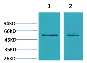 Cav β3 Rabbit pAb Antibody