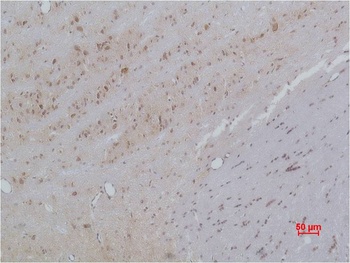 Cav β3 Rabbit pAb Antibody