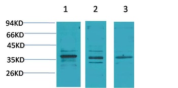 Cav γ2 Rabbit pAb Antibody