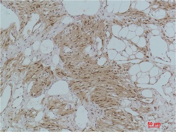 IκB α Rabbit pAb Antibody