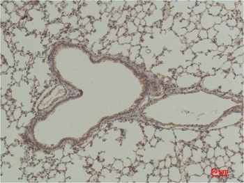 HAO1/GOX Rabbit pAb Antibody