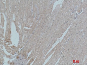 PPAR γ Rabbit pAb Antibody
