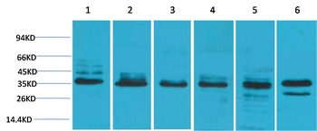 TBP Rabbit pAb Antibody