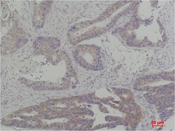 TBP Rabbit pAb Antibody
