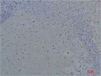 S100 β Rabbit pAb Antibody