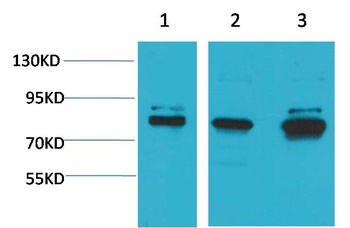 ASIC1 Rabbit pAb Antibody