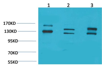 BAI1 Rabbit pAb Antibody