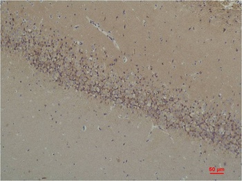 BAI1 Rabbit pAb Antibody