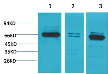 Bestrophin-1 Rabbit pAb Antibody
