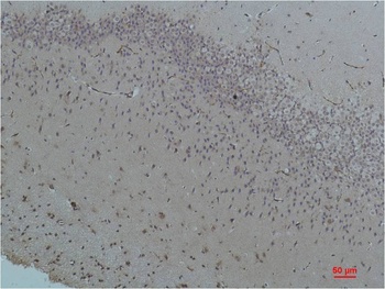 Bestrophin-1 Rabbit pAb Antibody
